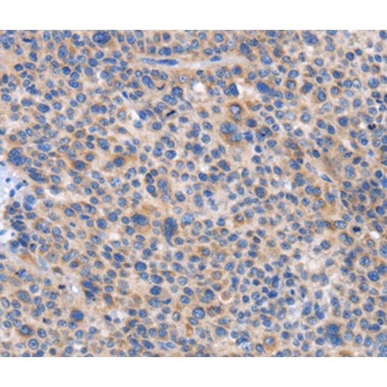 Immunohistochemistry - CARD17 Antibody from Signalway Antibody (37461) - Antibodies.com