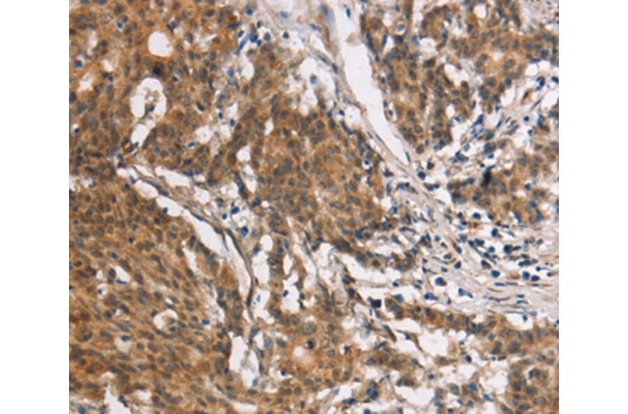 Immunohistochemistry - COL7A1 Antibody from Signalway Antibody (37510) - Antibodies.com