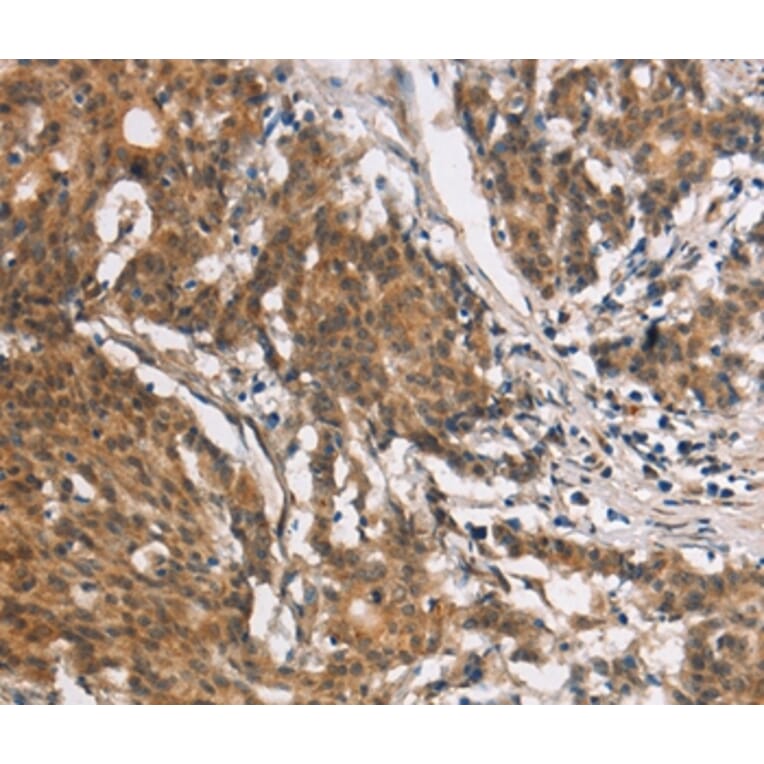 Immunohistochemistry - COL7A1 Antibody from Signalway Antibody (37510) - Antibodies.com