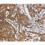 Immunohistochemistry - COL7A1 Antibody from Signalway Antibody (37510) - Antibodies.com