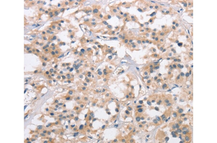 Immunohistochemistry - COL7A1 Antibody from Signalway Antibody (37510) - Antibodies.com