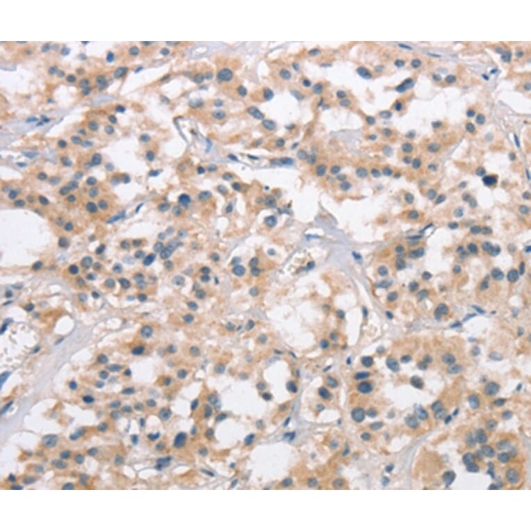 Immunohistochemistry - COL7A1 Antibody from Signalway Antibody (37510) - Antibodies.com