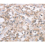 Immunohistochemistry - COL7A1 Antibody from Signalway Antibody (37510) - Antibodies.com
