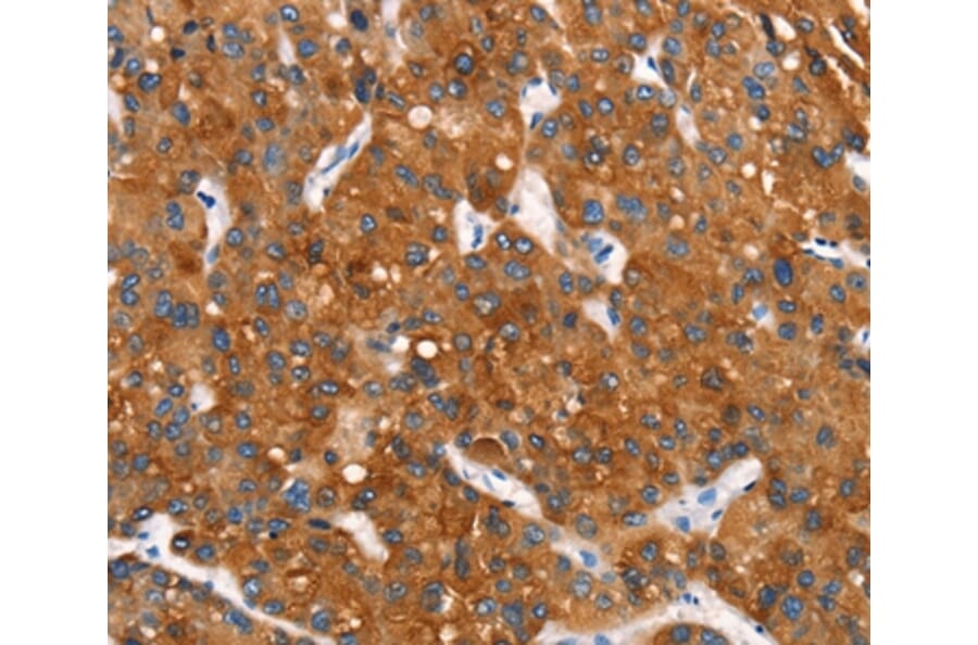 Immunohistochemistry - MT-CYB Antibody from Signalway Antibody (37517) - Antibodies.com