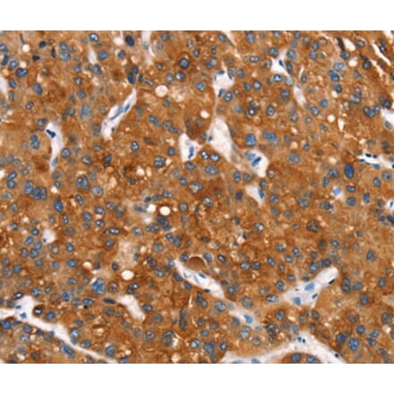 Immunohistochemistry - MT-CYB Antibody from Signalway Antibody (37517) - Antibodies.com