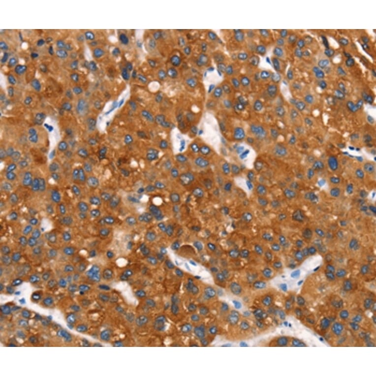 Immunohistochemistry - MT-CYB Antibody from Signalway Antibody (37517) - Antibodies.com