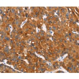 Immunohistochemistry - MT-CYB Antibody from Signalway Antibody (37517) - Antibodies.com