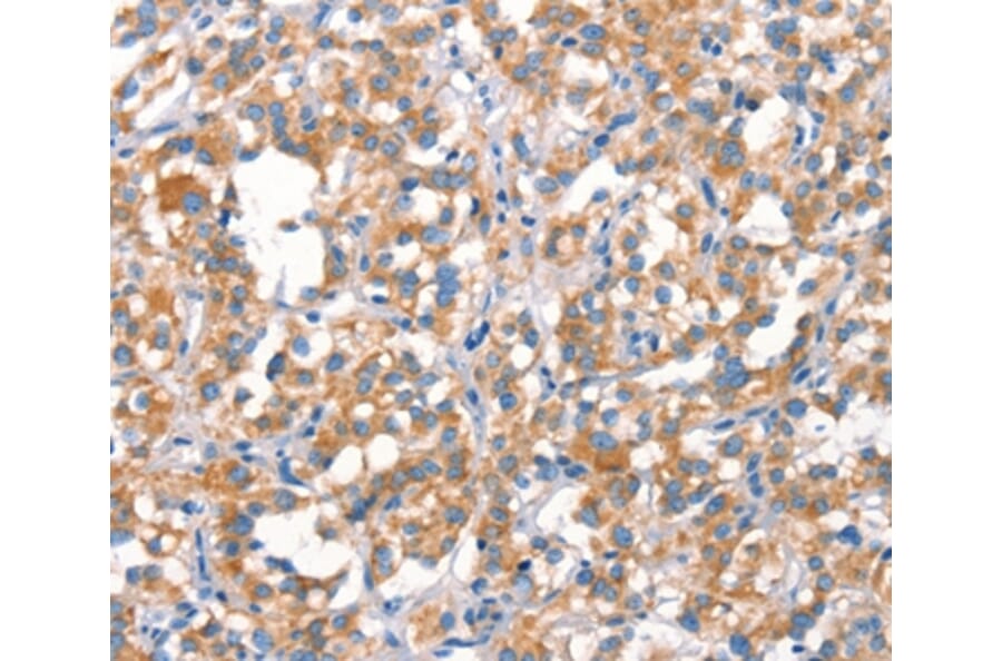 Immunohistochemistry - MT-CYB Antibody from Signalway Antibody (37517) - Antibodies.com