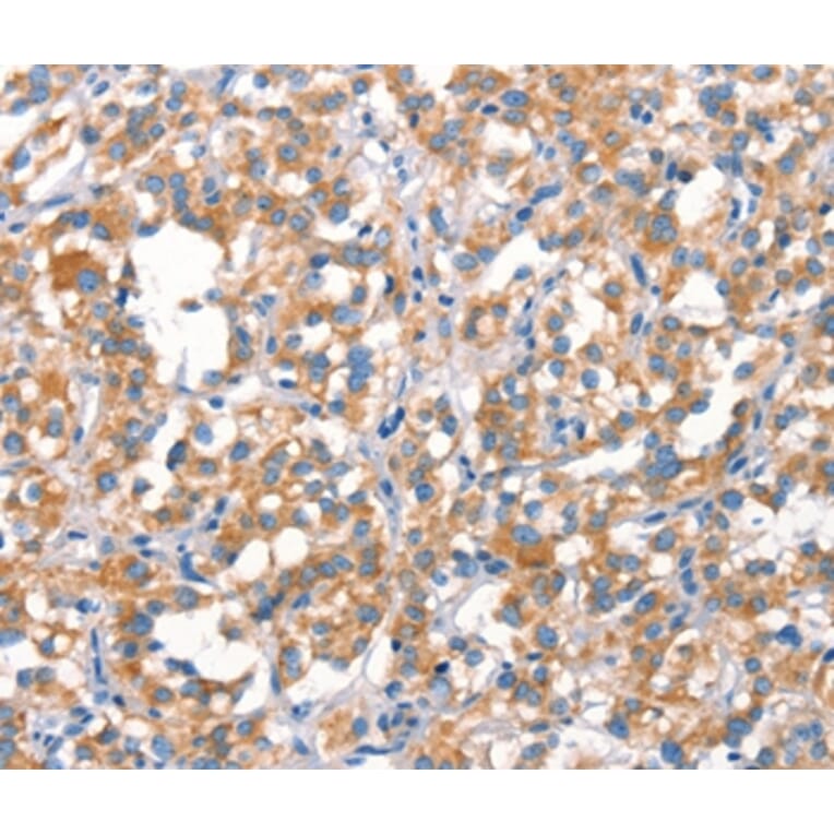 Immunohistochemistry - MT-CYB Antibody from Signalway Antibody (37517) - Antibodies.com