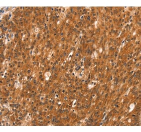 Immunohistochemistry - DAB2IP Antibody from Signalway Antibody (37520) - Antibodies.com