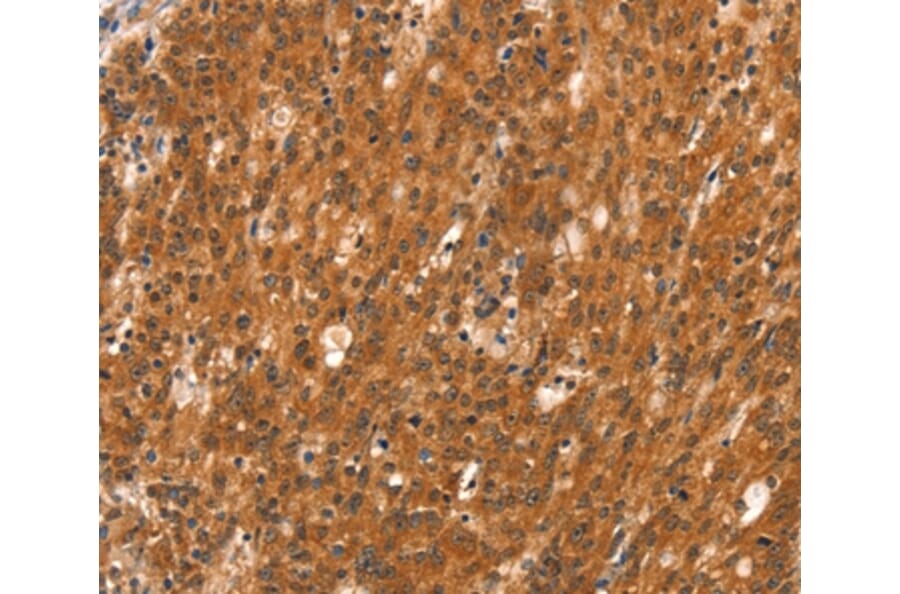 Immunohistochemistry - DAB2IP Antibody from Signalway Antibody (37520) - Antibodies.com
