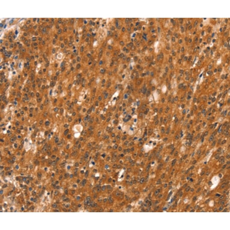 Immunohistochemistry - DAB2IP Antibody from Signalway Antibody (37520) - Antibodies.com