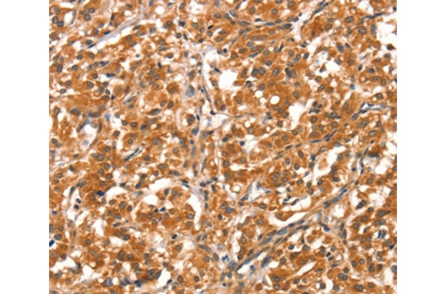 Immunohistochemistry - DAB2IP Antibody from Signalway Antibody (37520) - Antibodies.com