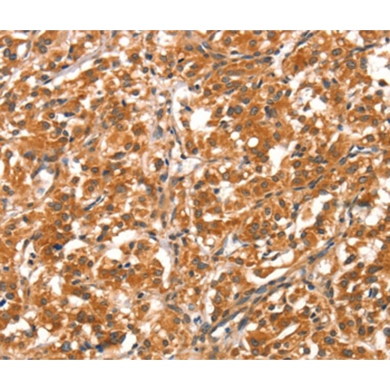 Immunohistochemistry - DAB2IP Antibody from Signalway Antibody (37520) - Antibodies.com