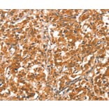 Immunohistochemistry - DAB2IP Antibody from Signalway Antibody (37520) - Antibodies.com