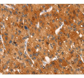 Immunohistochemistry - CLEC6A Antibody from Signalway Antibody (37525) - Antibodies.com