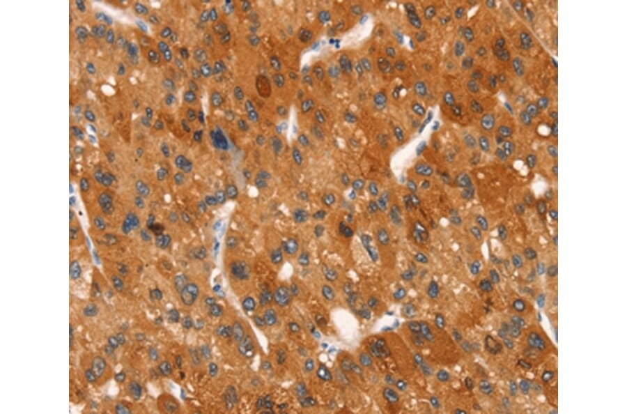 Immunohistochemistry - CLEC6A Antibody from Signalway Antibody (37525) - Antibodies.com