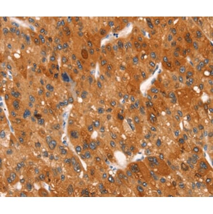 Immunohistochemistry - CLEC6A Antibody from Signalway Antibody (37525) - Antibodies.com