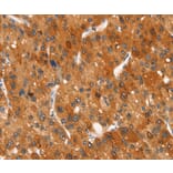 Immunohistochemistry - CLEC6A Antibody from Signalway Antibody (37525) - Antibodies.com