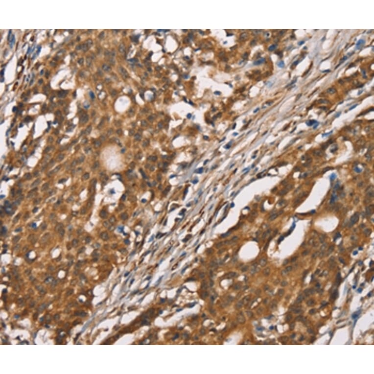 Immunohistochemistry - DICER1 Antibody from Signalway Antibody (37534) - Antibodies.com