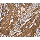 Immunohistochemistry - DICER1 Antibody from Signalway Antibody (37534) - Antibodies.com