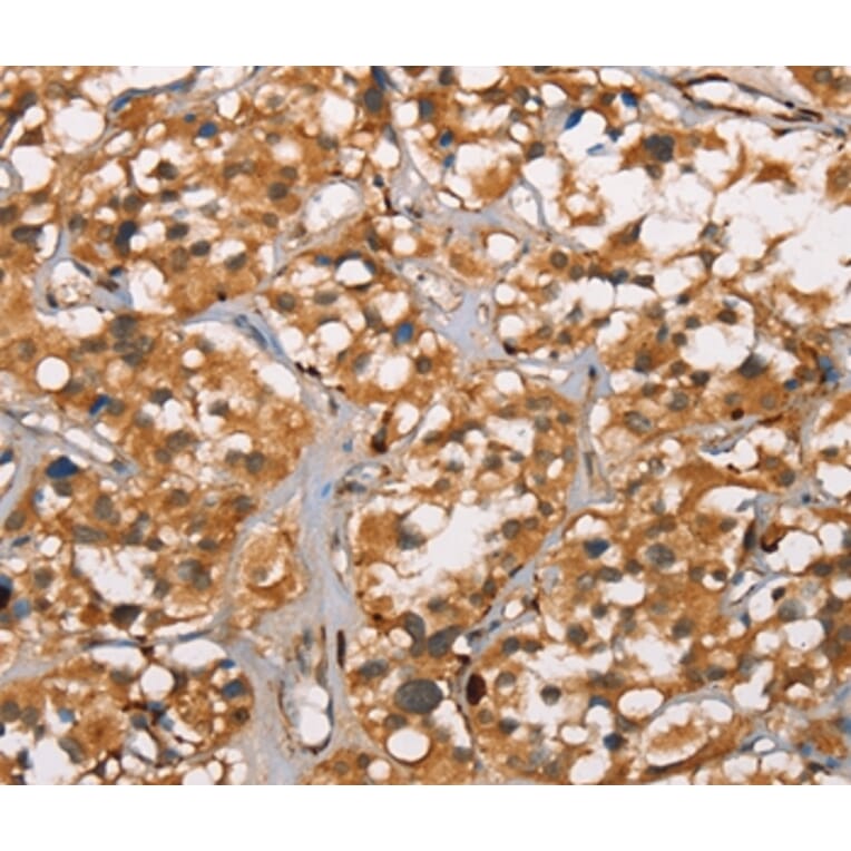 Immunohistochemistry - DICER1 Antibody from Signalway Antibody (37534) - Antibodies.com