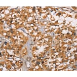 Immunohistochemistry - DICER1 Antibody from Signalway Antibody (37534) - Antibodies.com