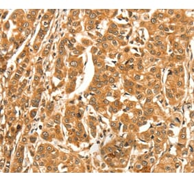 Immunohistochemistry - DIRAS1 Antibody from Signalway Antibody (37536) - Antibodies.com