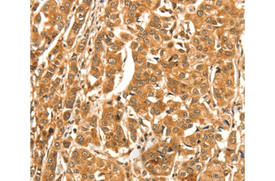 Immunohistochemistry - DIRAS1 Antibody from Signalway Antibody (37536) - Antibodies.com