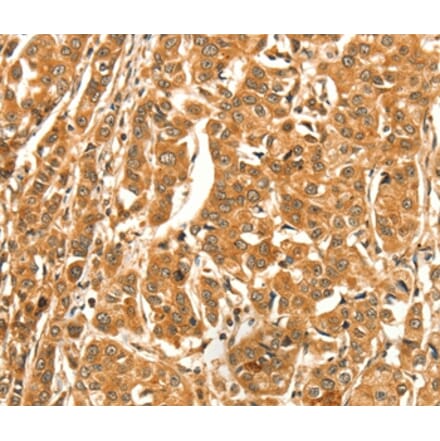 Immunohistochemistry - DIRAS1 Antibody from Signalway Antibody (37536) - Antibodies.com