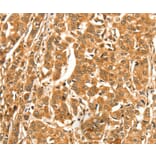 Immunohistochemistry - DIRAS1 Antibody from Signalway Antibody (37536) - Antibodies.com