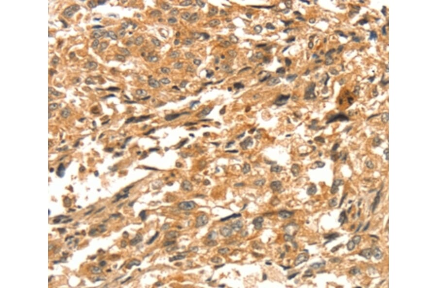 Immunohistochemistry - DIRAS1 Antibody from Signalway Antibody (37536) - Antibodies.com