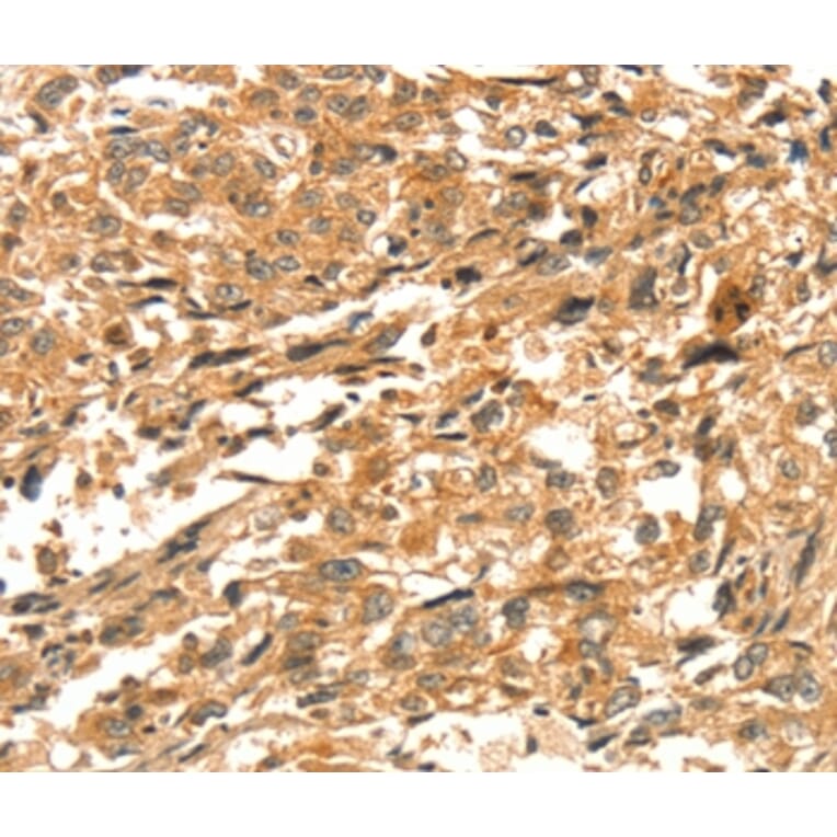 Immunohistochemistry - DIRAS1 Antibody from Signalway Antibody (37536) - Antibodies.com