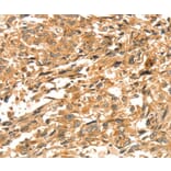 Immunohistochemistry - DIRAS1 Antibody from Signalway Antibody (37536) - Antibodies.com