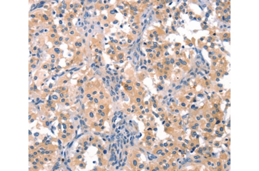 Immunohistochemistry - EIF4G1 Antibody from Signalway Antibody (37544) - Antibodies.com
