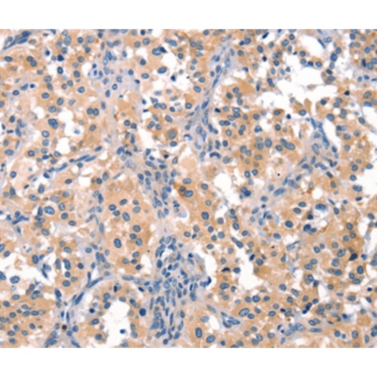 Immunohistochemistry - EIF4G1 Antibody from Signalway Antibody (37544) - Antibodies.com