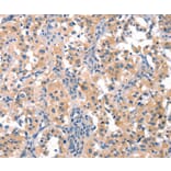 Immunohistochemistry - EIF4G1 Antibody from Signalway Antibody (37544) - Antibodies.com