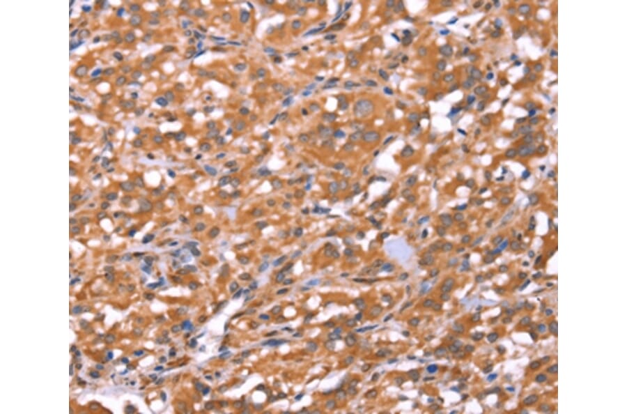 Immunohistochemistry - FAM13B Antibody from Signalway Antibody (37564) - Antibodies.com