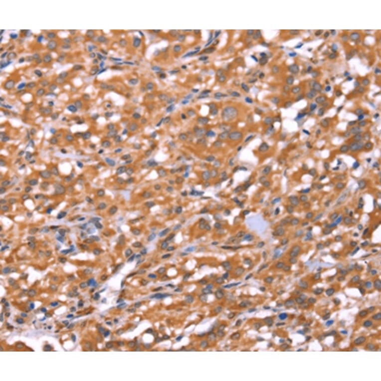 Immunohistochemistry - FAM13B Antibody from Signalway Antibody (37564) - Antibodies.com