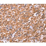 Immunohistochemistry - FAM13B Antibody from Signalway Antibody (37564) - Antibodies.com