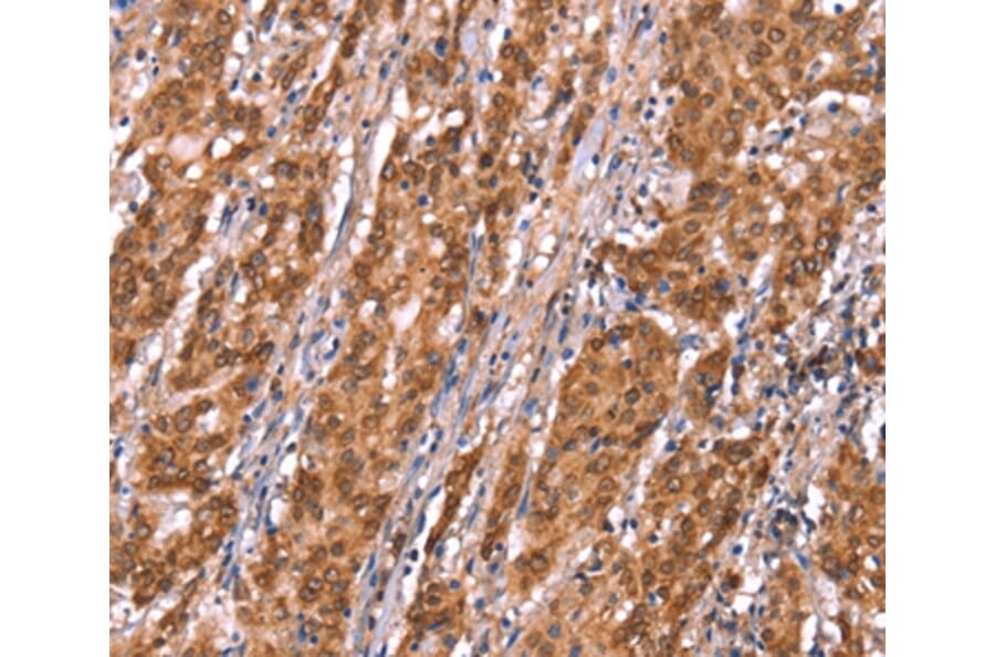 Immunohistochemistry - FAM13B Antibody from Signalway Antibody (37564) - Antibodies.com
