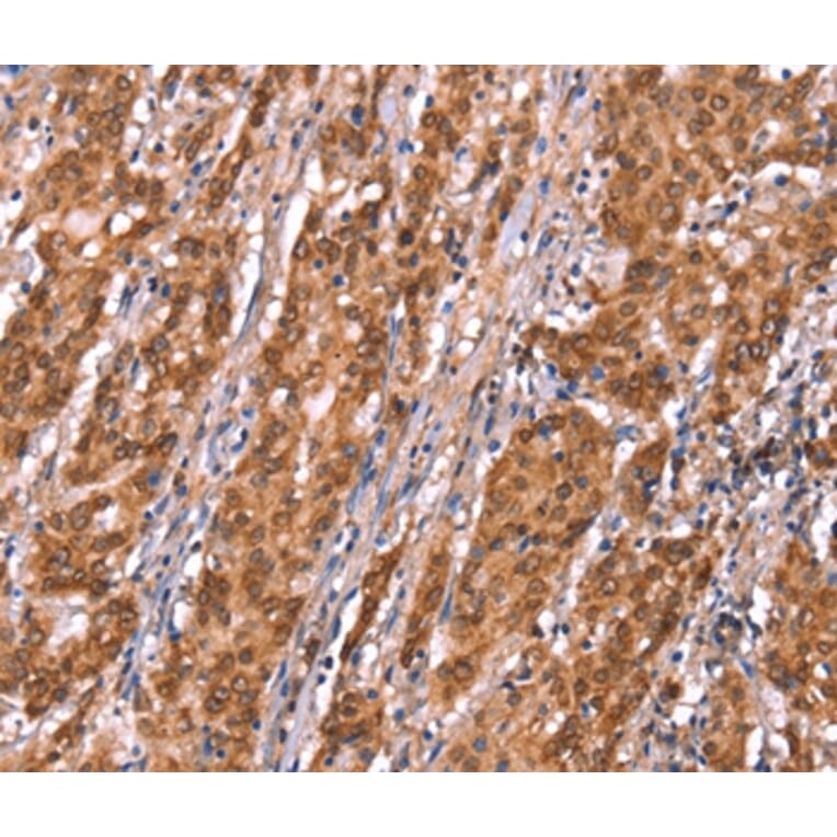 Immunohistochemistry - FAM13B Antibody from Signalway Antibody (37564) - Antibodies.com