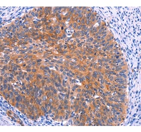 Immunohistochemistry - PTPN13 Antibody from Signalway Antibody (37565) - Antibodies.com