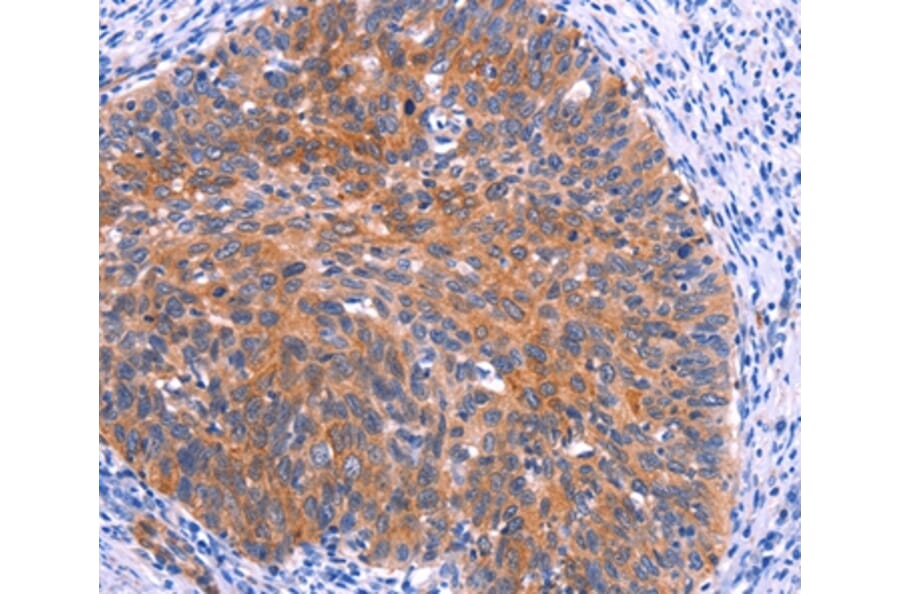 Immunohistochemistry - PTPN13 Antibody from Signalway Antibody (37565) - Antibodies.com