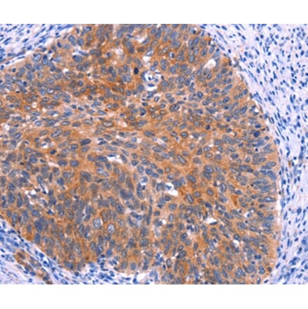 Immunohistochemistry - PTPN13 Antibody from Signalway Antibody (37565) - Antibodies.com