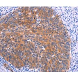 Immunohistochemistry - PTPN13 Antibody from Signalway Antibody (37565) - Antibodies.com