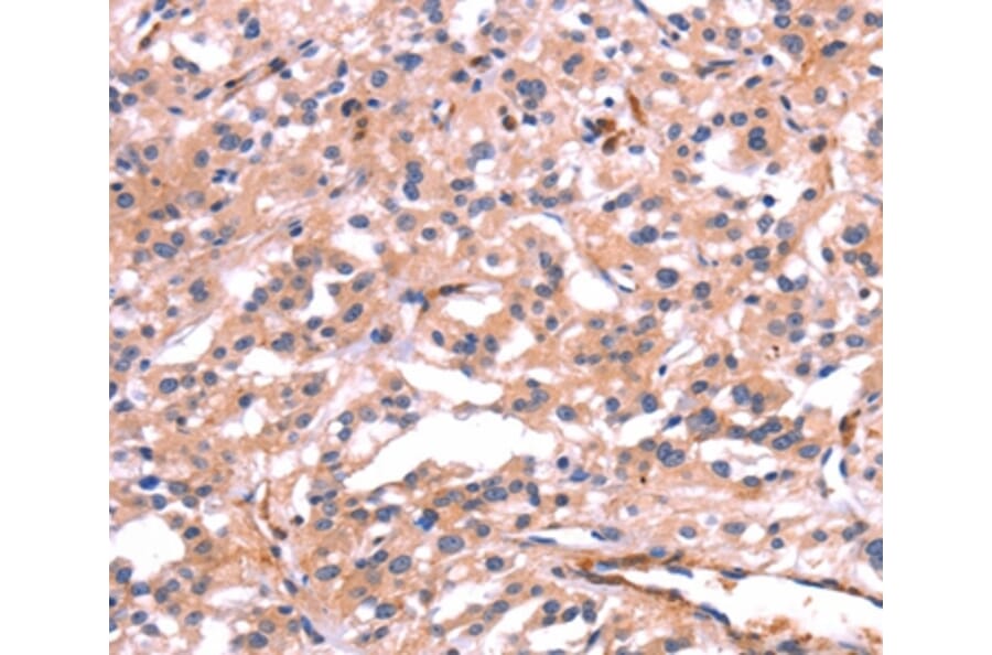 Immunohistochemistry - PTPN13 Antibody from Signalway Antibody (37565) - Antibodies.com