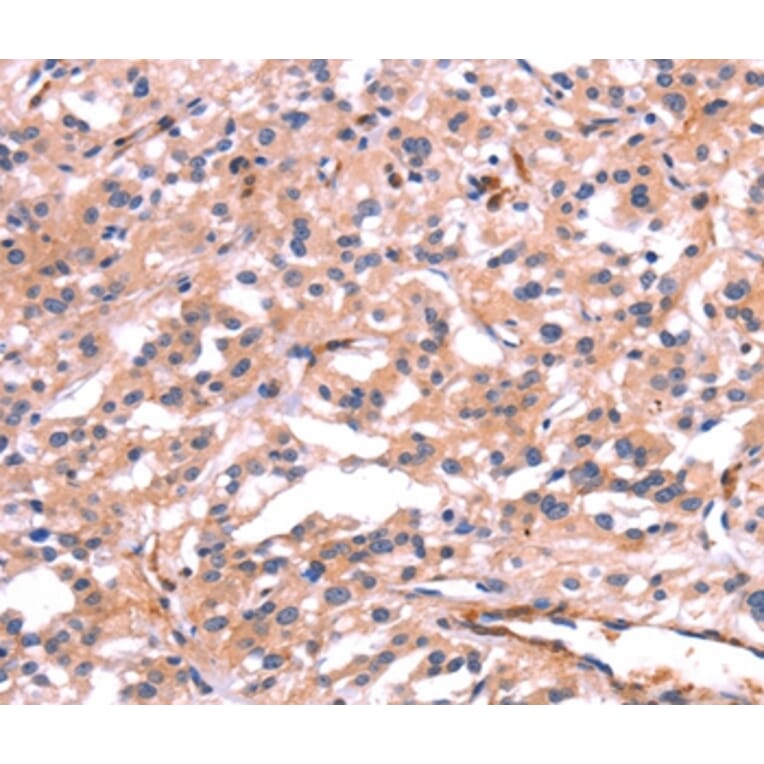 Immunohistochemistry - PTPN13 Antibody from Signalway Antibody (37565) - Antibodies.com