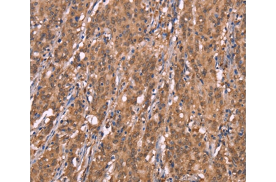 Immunohistochemistry - FBXO31 Antibody from Signalway Antibody (37567) - Antibodies.com