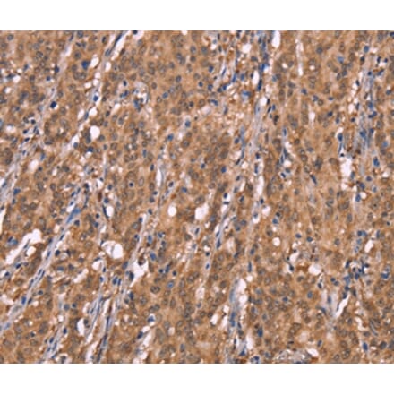 Immunohistochemistry - FBXO31 Antibody from Signalway Antibody (37567) - Antibodies.com